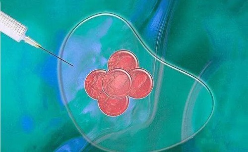 試管嬰兒胚胎等級怎么分？什么是養囊？