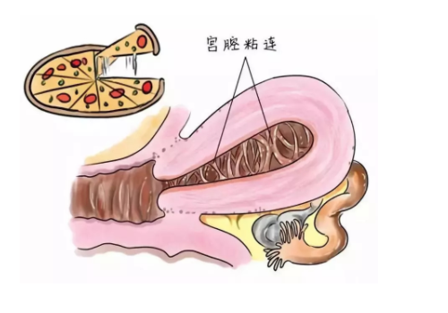美國試管嬰兒費(fèi)用及流程？