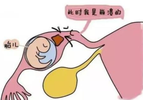 試管嬰兒幾代好呢？