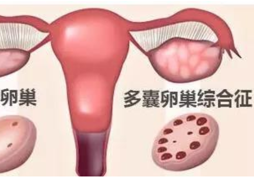俄羅斯試管哪里好需要注意什么？