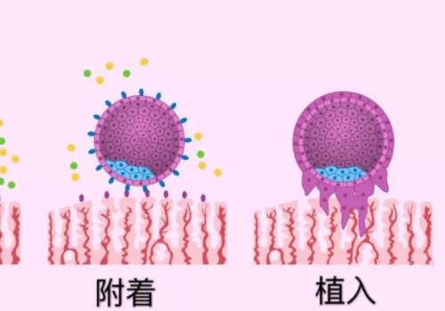 俄羅斯試管哪里好篩查費(fèi)用多少？?